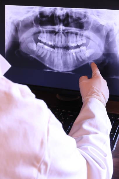 Best Emergency Tooth Extraction in Jasper, TX