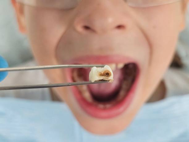 Best Pediatric Emergency Dentist in Jasper, TX
