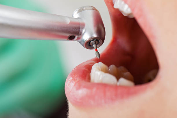Best Emergency TMJ Treatment in Jasper, TX